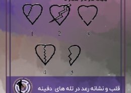 نشانه قلب در دفینه یابی